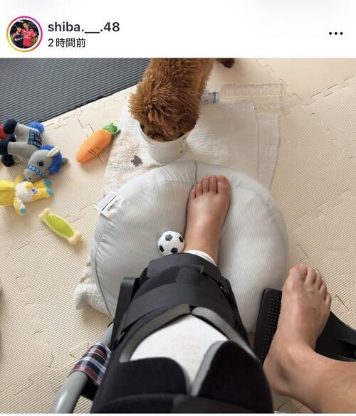 インスタグラムに大ケガを負った左足の写真を投稿した柴山昌也