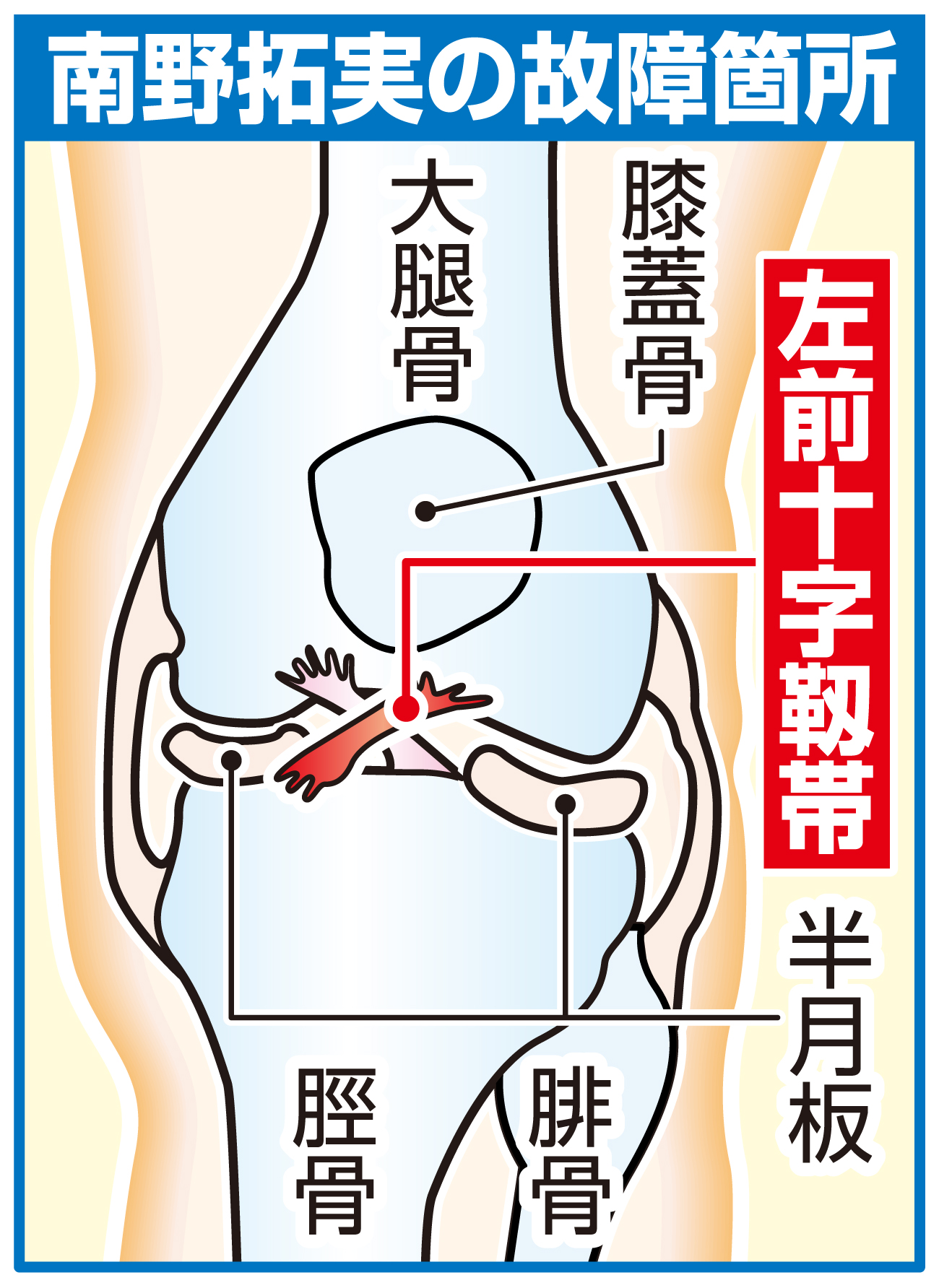 【イラスト】南野拓実の故障箇所