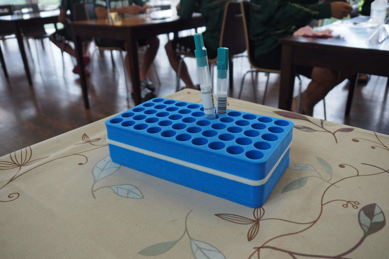 J2東京Vが使用したPCR検査のキット（Jリーグ提供）