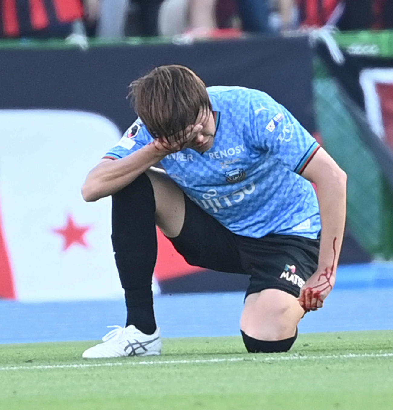 川崎F対札幌　後半、ハイボールを競り合い頭を負傷した川崎F大南（撮影・山崎安昭）