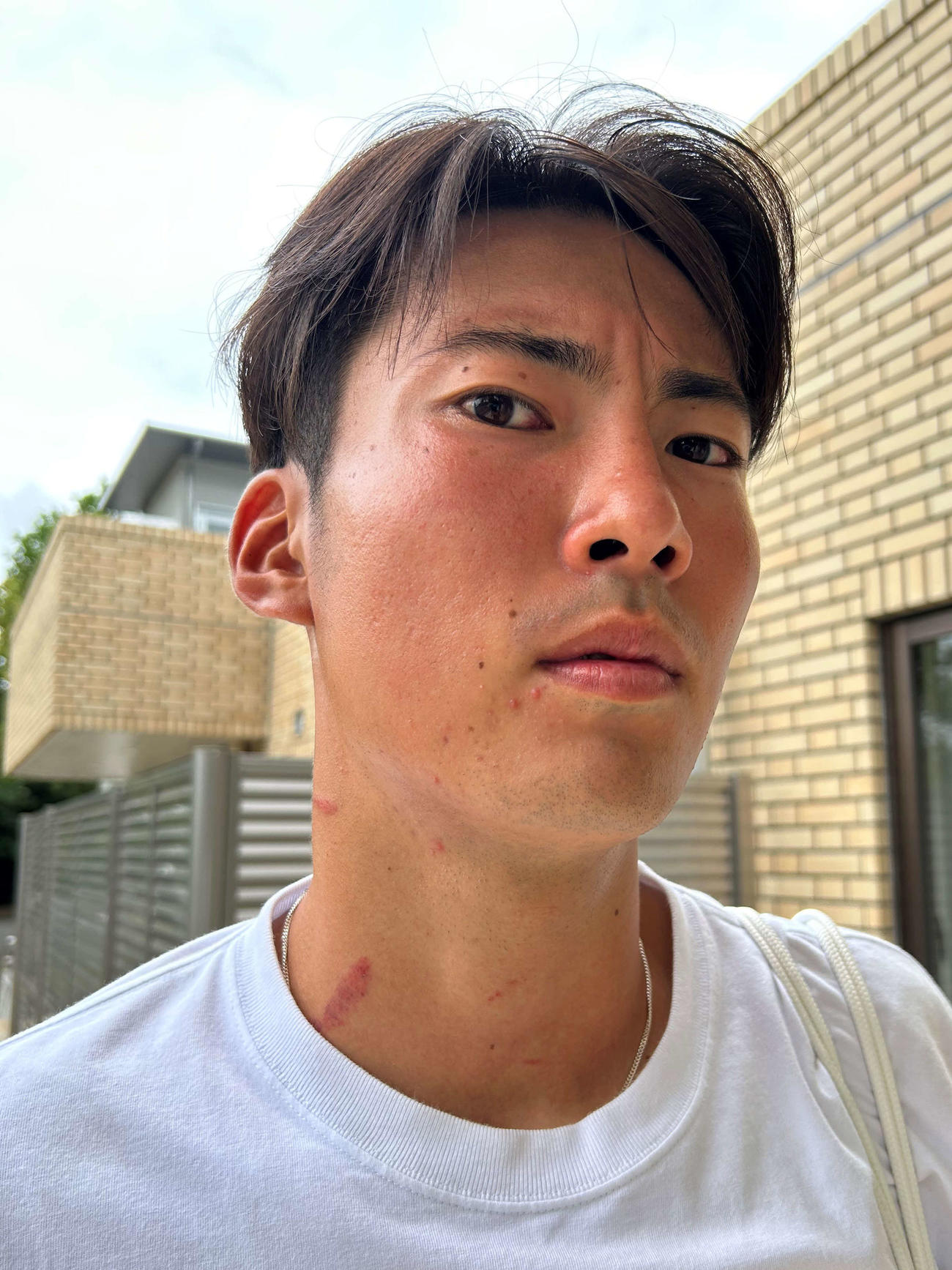 順大相手に体を張り続けた東京V佐古。その首には複数のアザができた