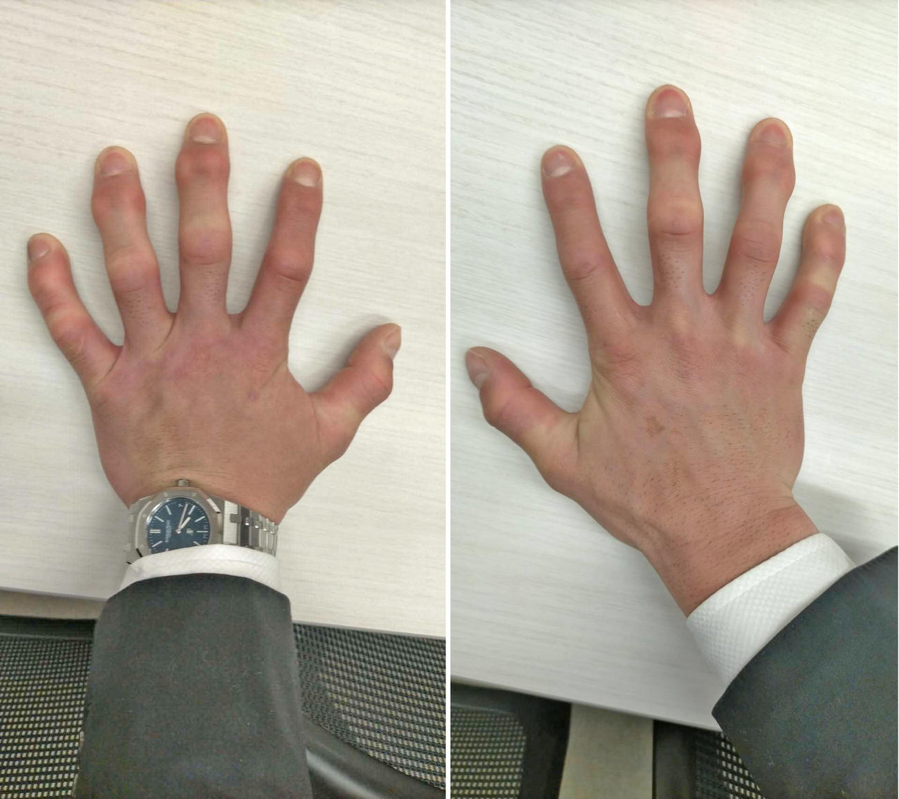引退会見を終えた後に撮影させてもらった大野の手