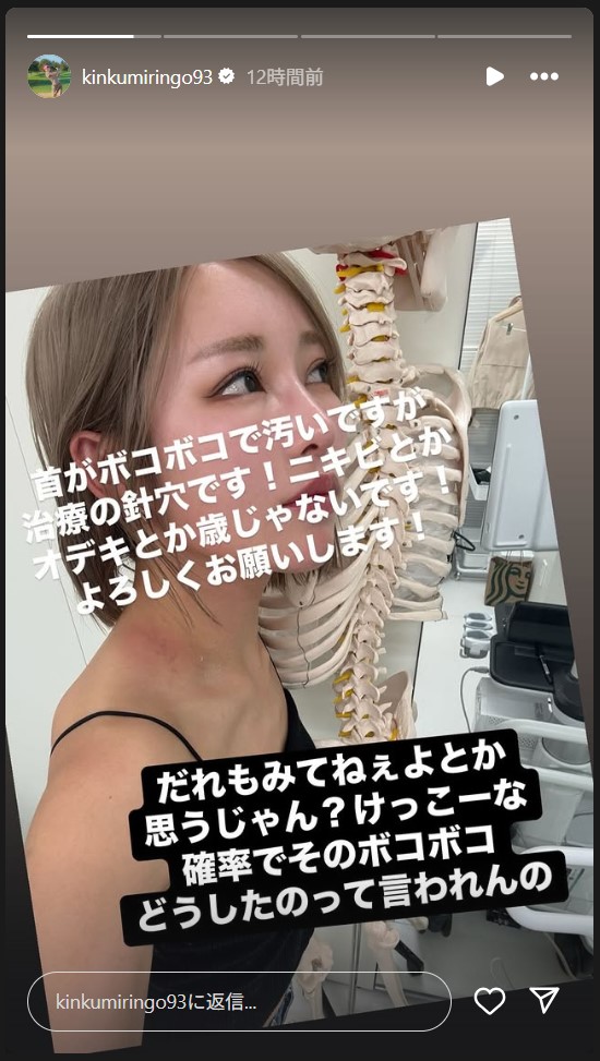 金田久美子のストーリーズから
