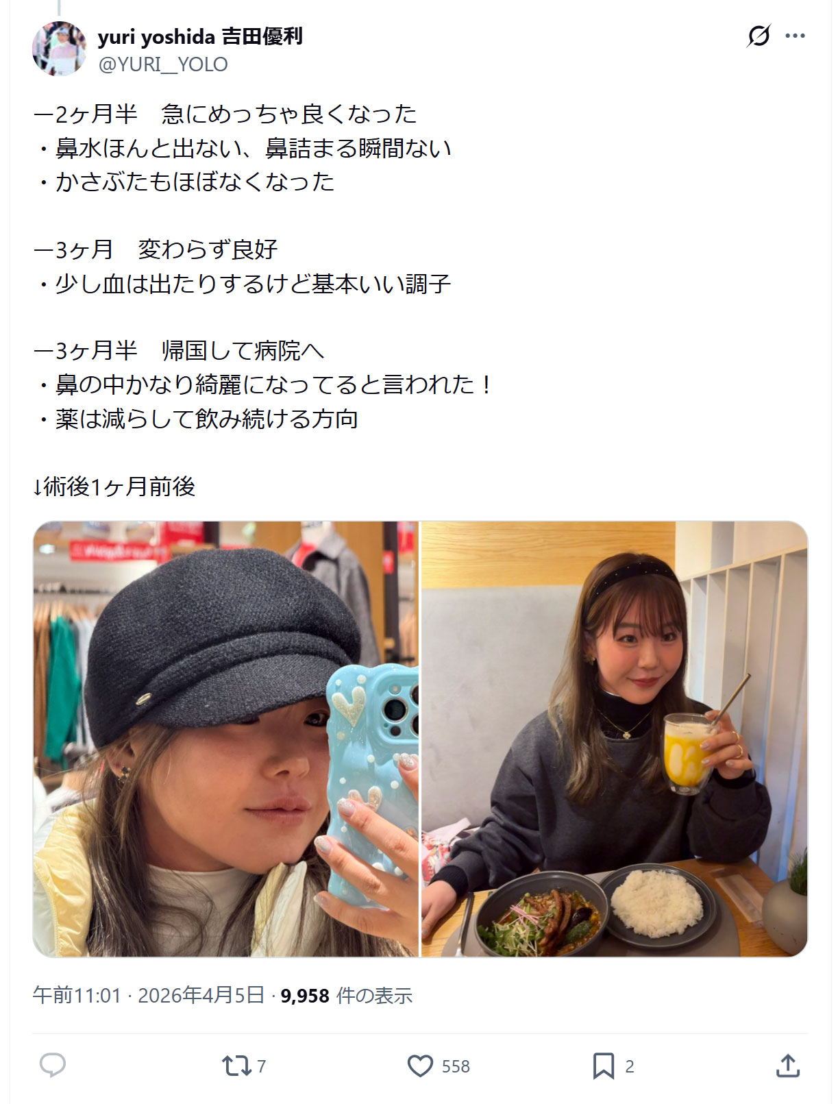 吉田優利のXから
