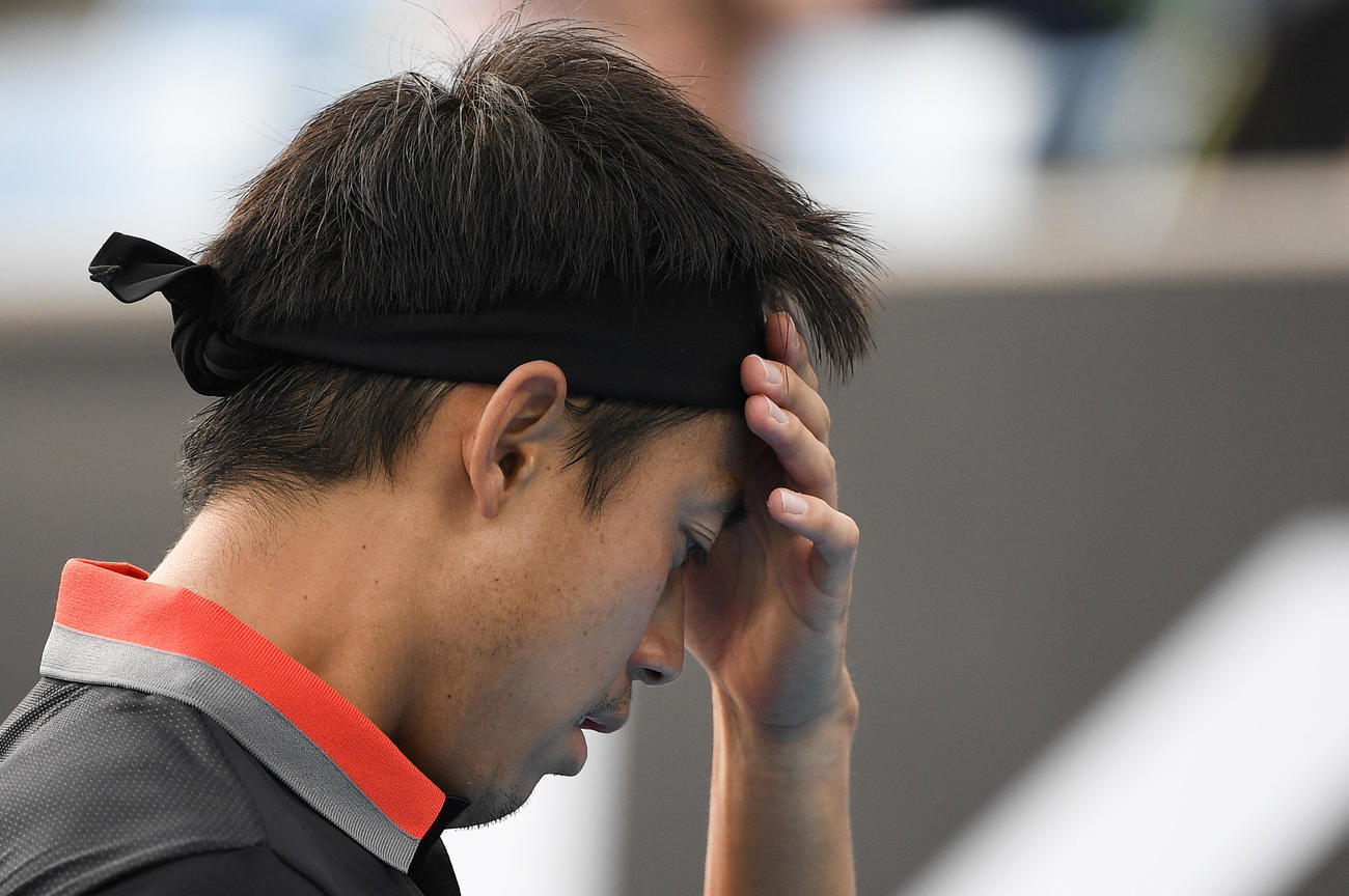 カレニョブスタ戦で額に手をおく錦織（AP）