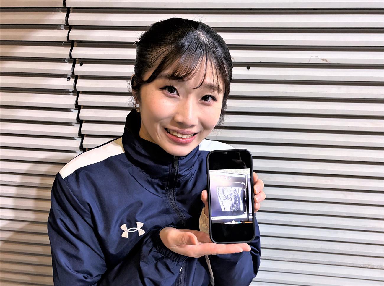 MRI検査の画像を見せながら前十字靭帯断裂時について振り返った大谷理麗花（2026年1月撮影）