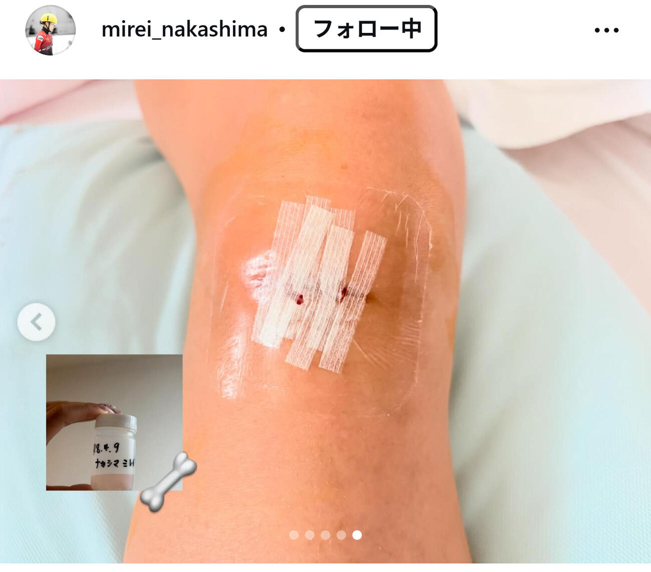 中島未莉のインスタグラムから