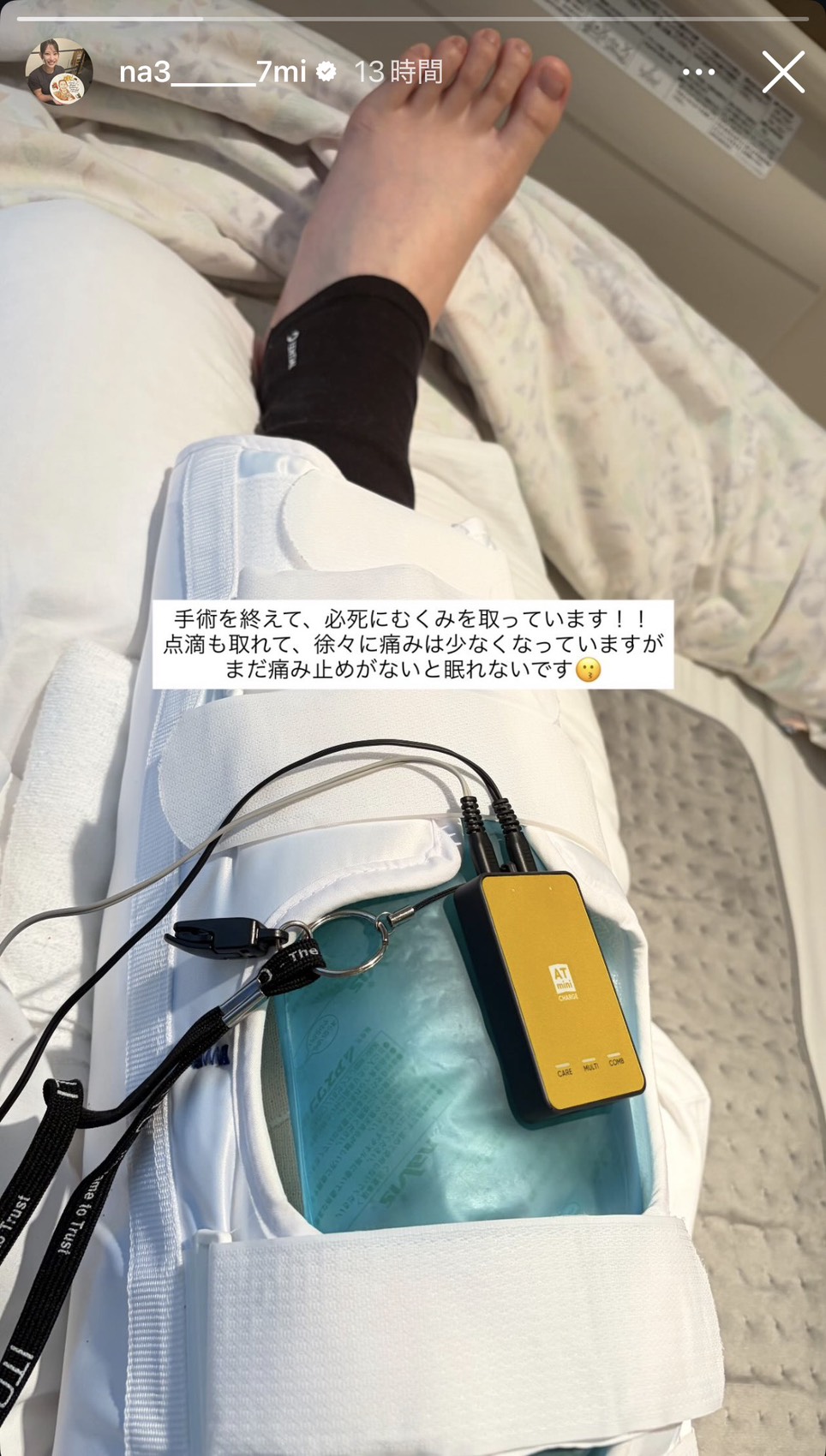 インスタグラムで手術を終えたことを報告した松山奈未（画像はスクリーンショット）