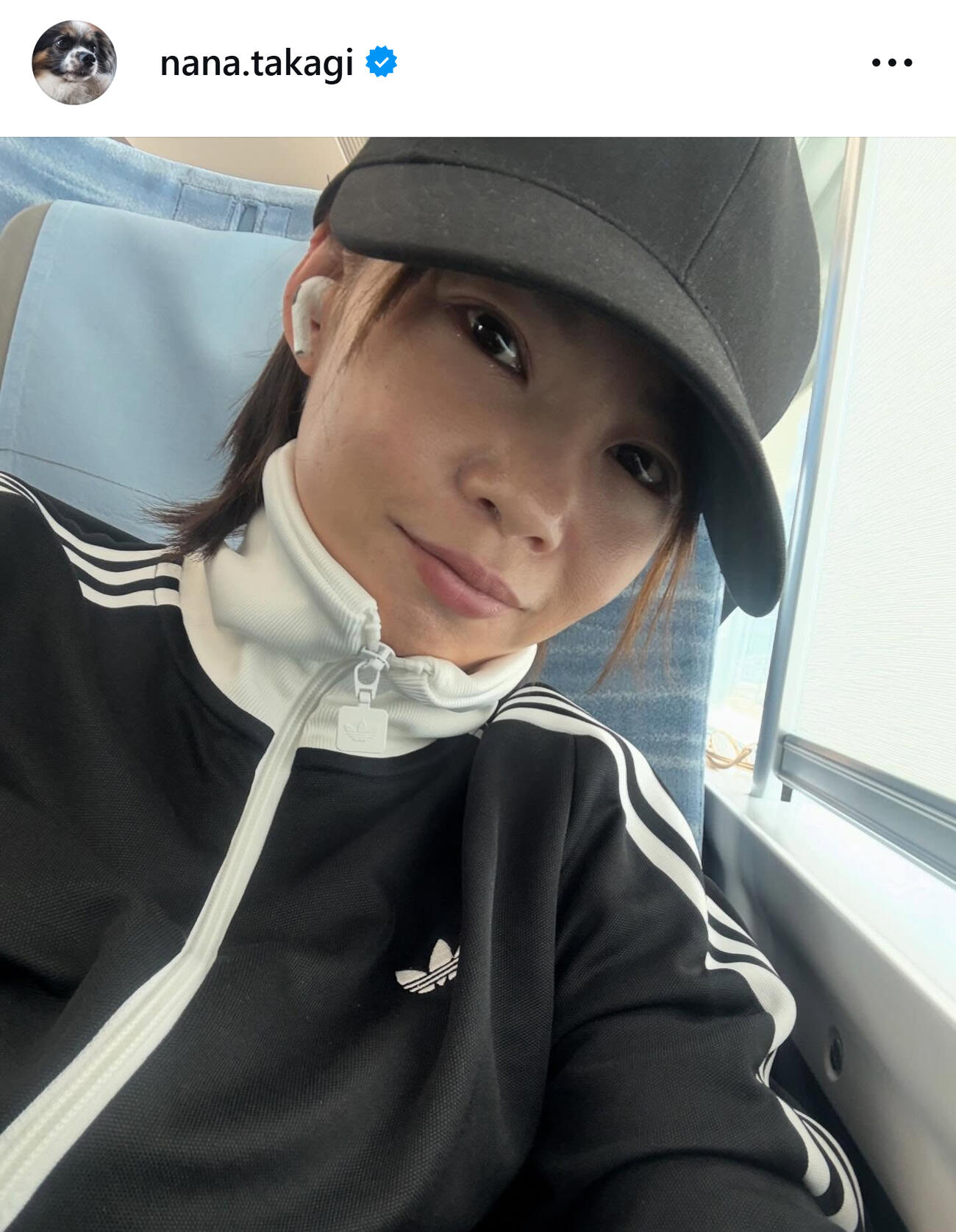 髪の毛伸ばし中の高木菜那さん（高木菜那さんのインスタグラムから）